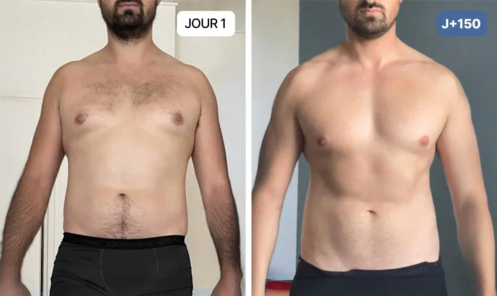 Nuclever Cortisol Manager Vorher Nachher Mann — flacherer Bauch nach 150 Tagen