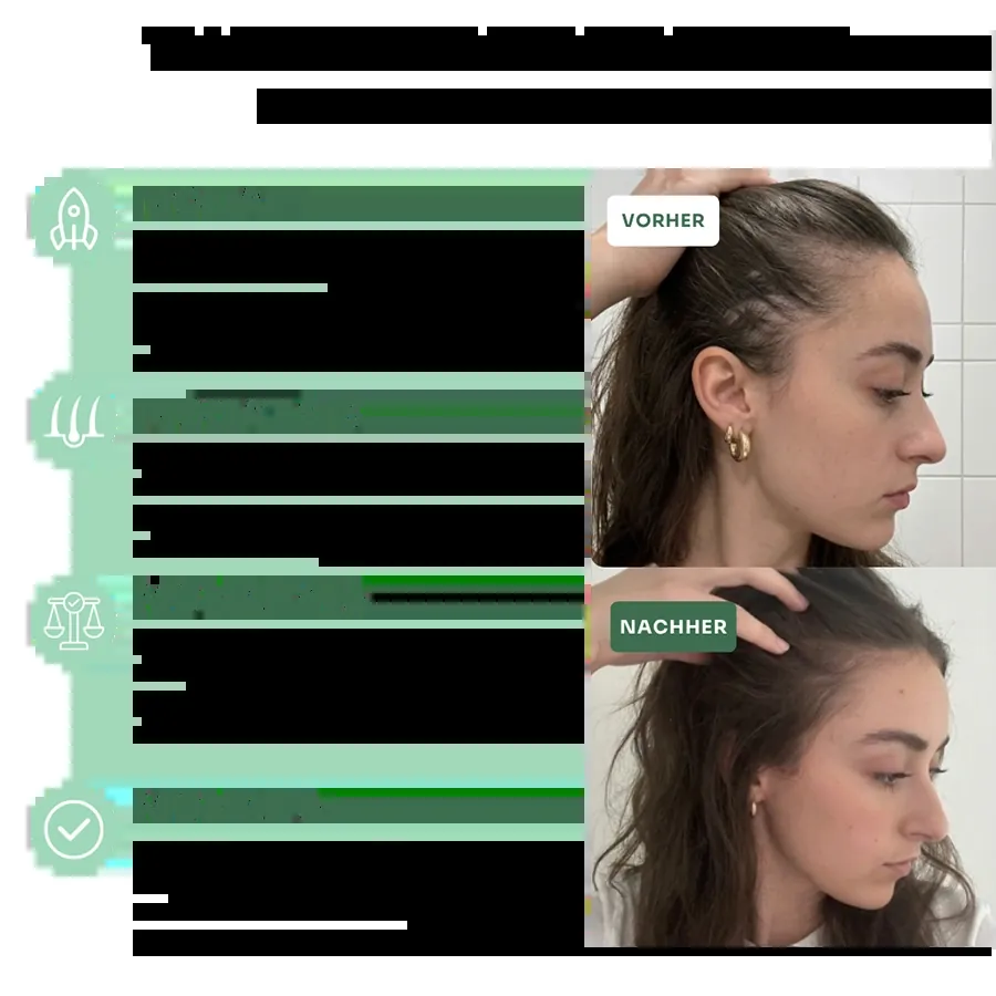 Nuclever DHT Blocker — wann erste Ergebnisse sichtbar sind: Monat 1 bis 6+